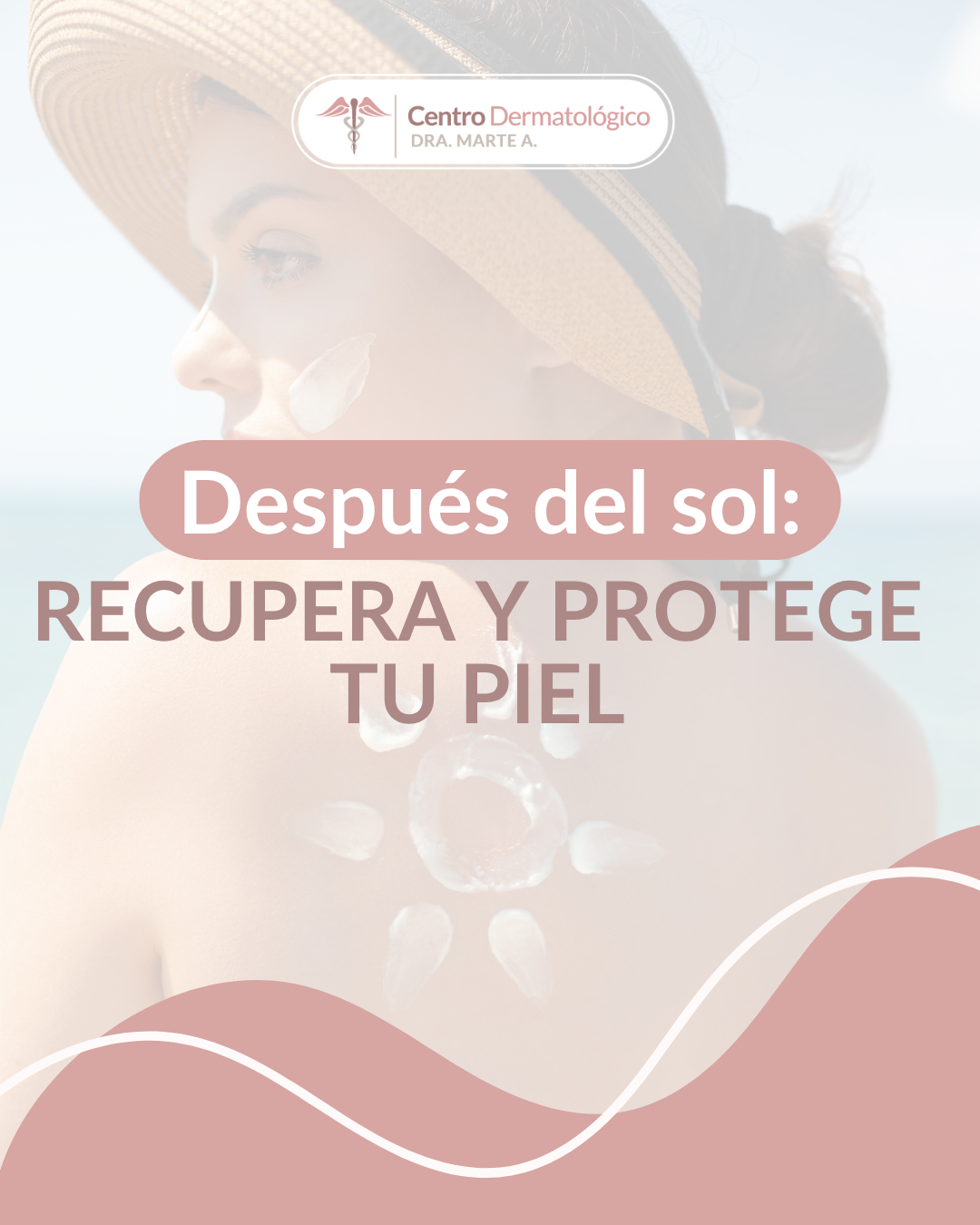 El cuidado de la piel después de una intensa exposición al sol